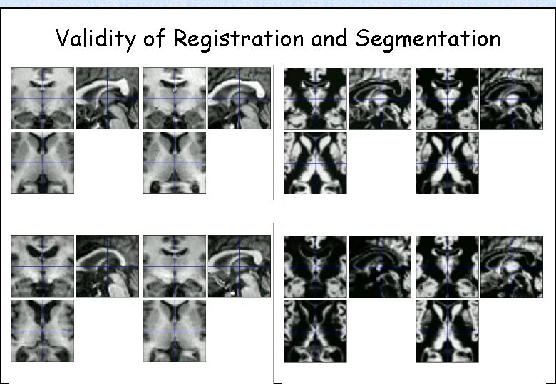 Validity of Registration and Segmentation 