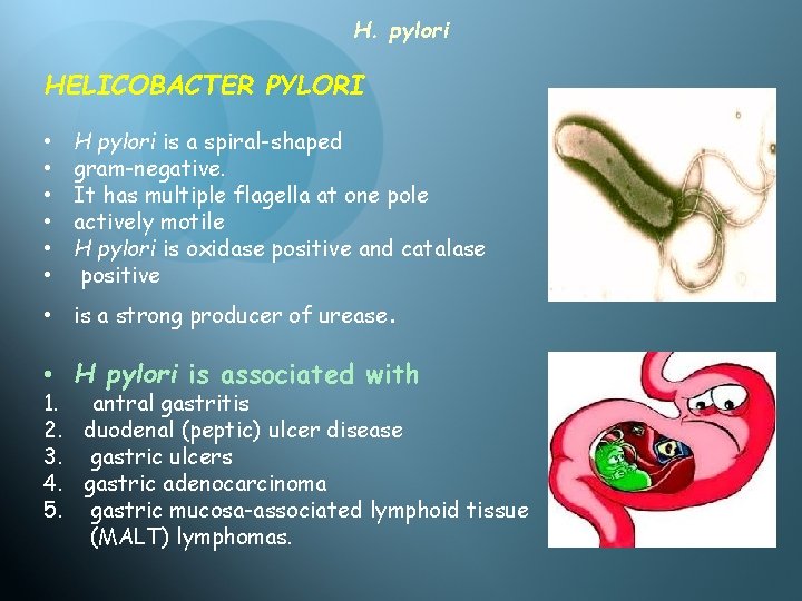 H. pylori HELICOBACTER PYLORI • • • H pylori is a spiral-shaped gram-negative. It