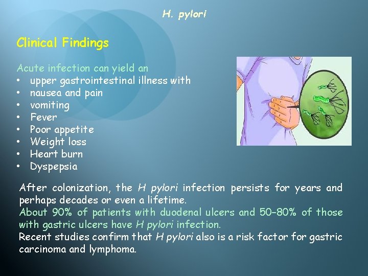 H. pylori Clinical Findings Acute infection can yield an • upper gastrointestinal illness with