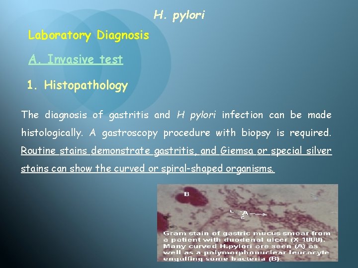 H. pylori Laboratory Diagnosis A. Invasive test 1. Histopathology The diagnosis of gastritis and