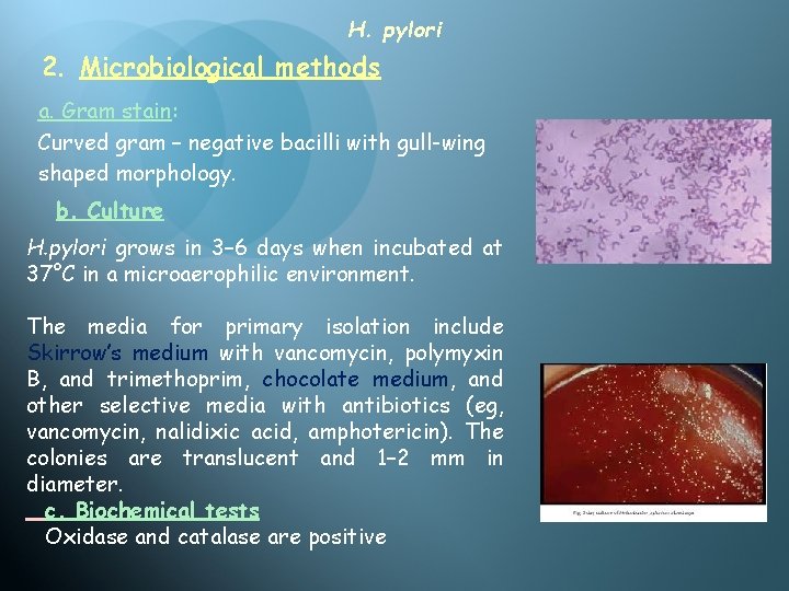 H. pylori 2. Microbiological methods a. Gram stain: Curved gram – negative bacilli with