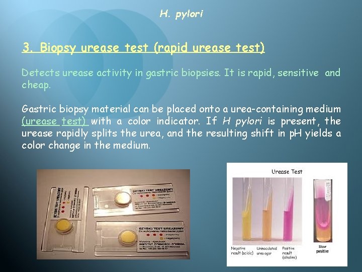 CAMPYLOBACTER and HELICOBACTER Dr Wasan Abdulilah Bakir CAMPYLOBACTER