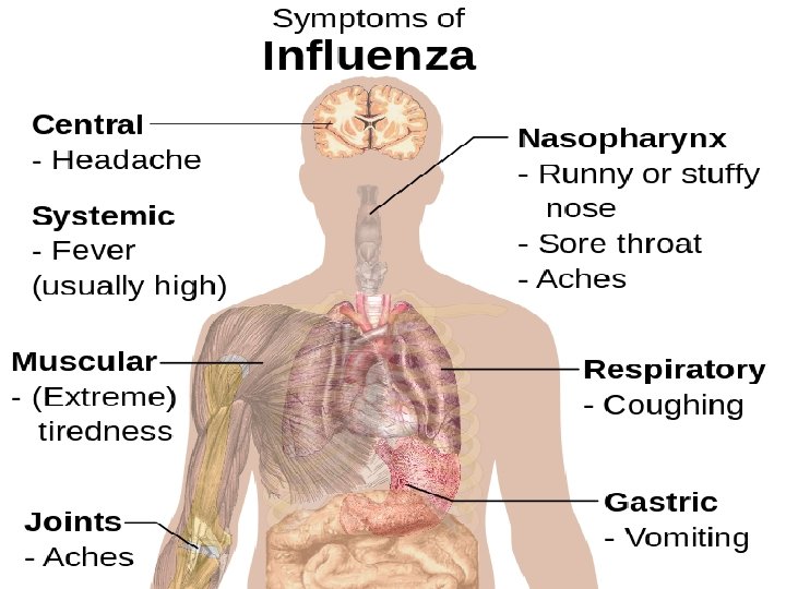Flu Vaccine Certain people are more likely to catch flu, such as: • anyone