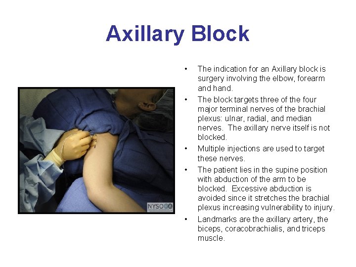 Axillary Block • • • The indication for an Axillary block is surgery involving