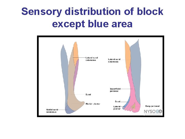 Sensory distribution of block except blue area 