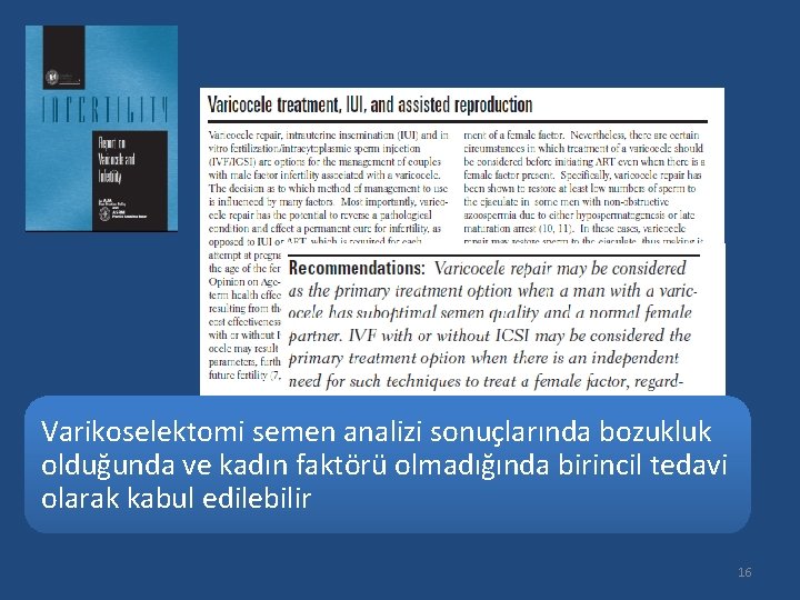 Varikoselektomi semen analizi sonuçlarında bozukluk olduğunda ve kadın faktörü olmadığında birincil tedavi olarak kabul