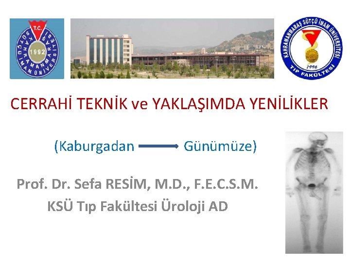 CERRAHİ TEKNİK ve YAKLAŞIMDA YENİLİKLER (Kaburgadan Günümüze) Prof. Dr. Sefa RESİM, M. D. ,