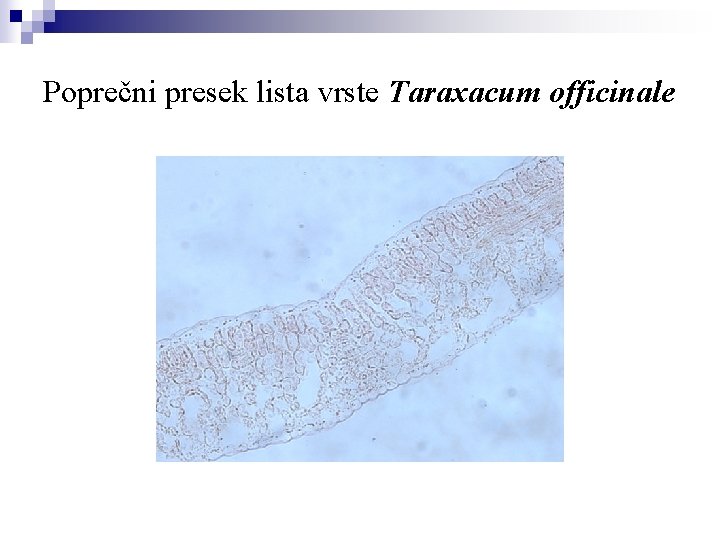 Poprečni presek lista vrste Taraxacum officinale 