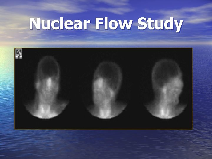 Nuclear Flow Study 