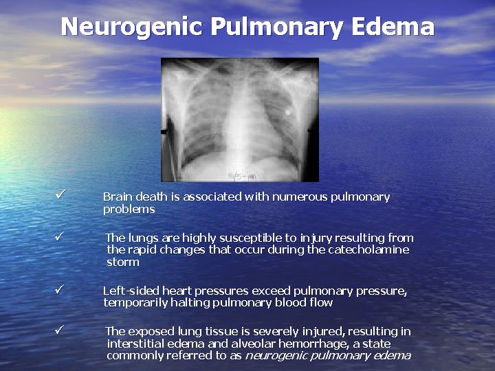 Neurogenic Pulmonary Edema ü Brain death is associated with numerous pulmonary problems ü The