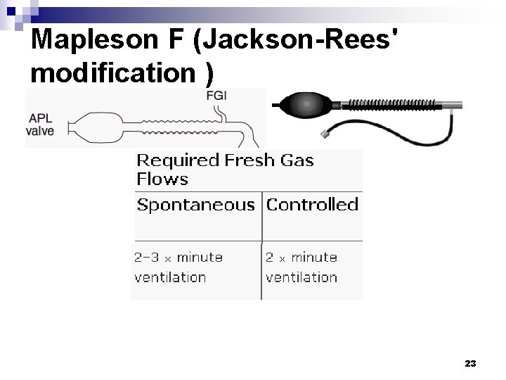 Mapleson F (Jackson-Rees' modification ) 23 