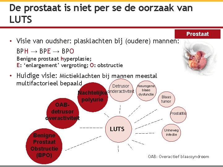 De prostaat is niet per se de oorzaak van LUTS • Visie van oudsher: