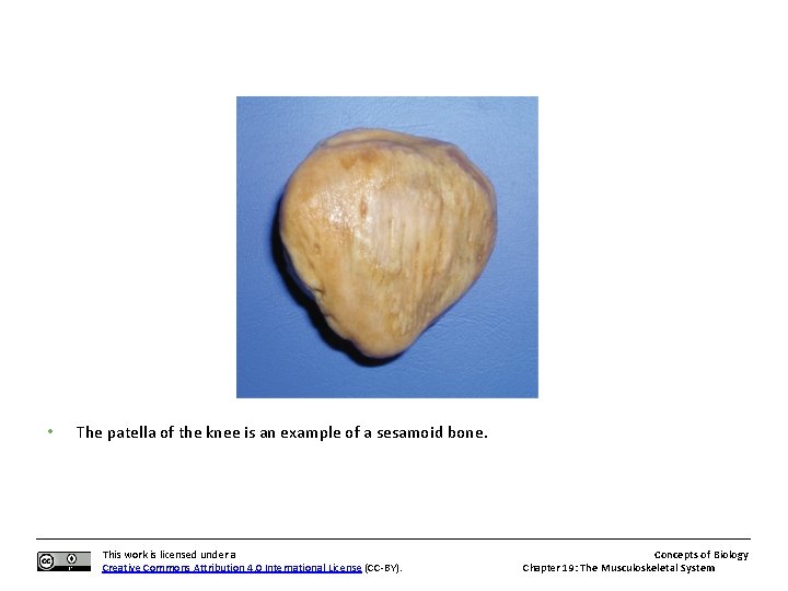  • The patella of the knee is an example of a sesamoid bone.