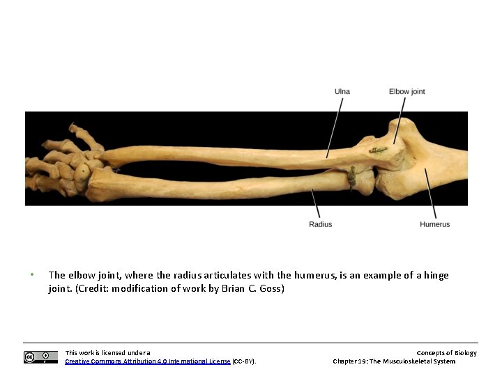  • The elbow joint, where the radius articulates with the humerus, is an