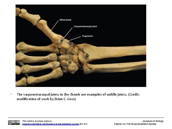  • The carpometacarpal joints in the thumb are examples of saddle joints. (Credit: