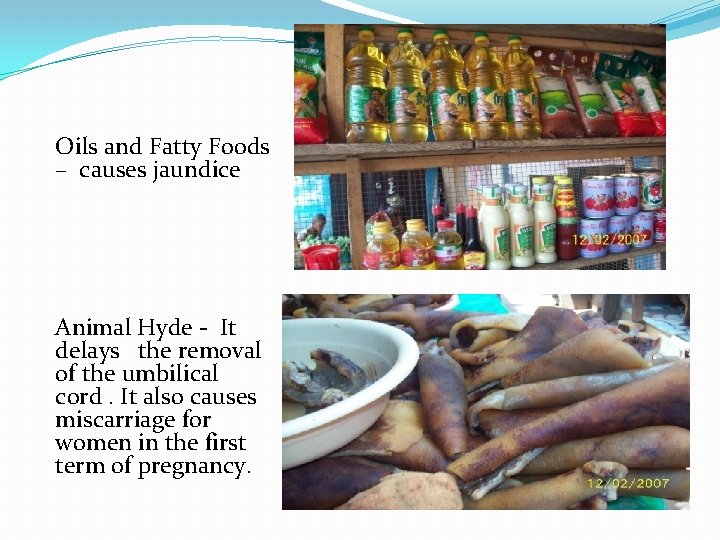 Oils and Fatty Foods – causes jaundice Animal Hyde - It delays the removal