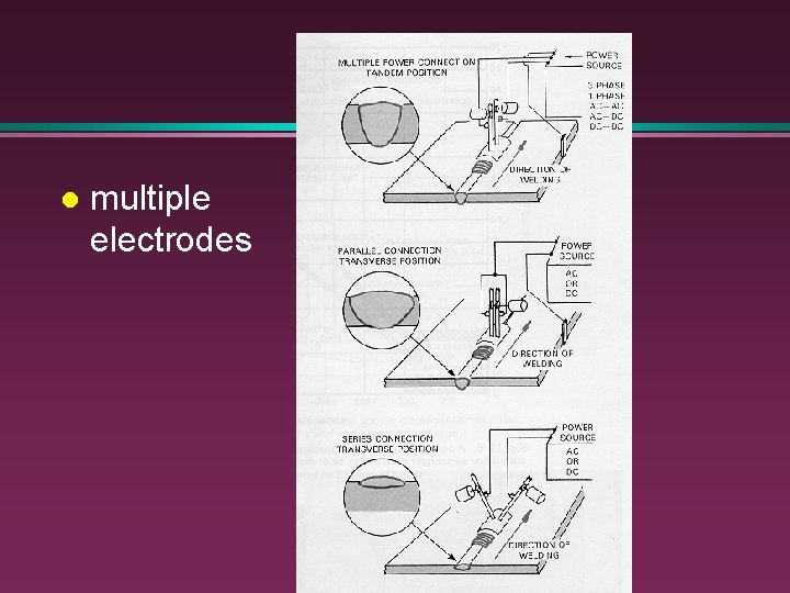 l multiple electrodes 