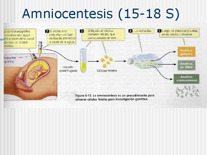 Amniocentesis (15 -18 S) 