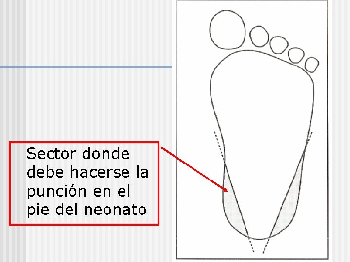 Sector donde debe hacerse la punción en el pie del neonato 