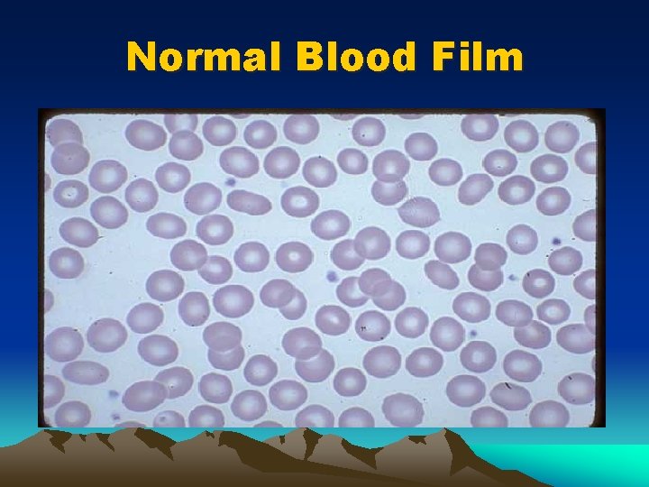 Normal Blood Film 