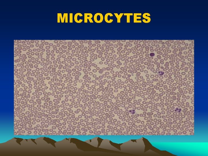 MICROCYTES 