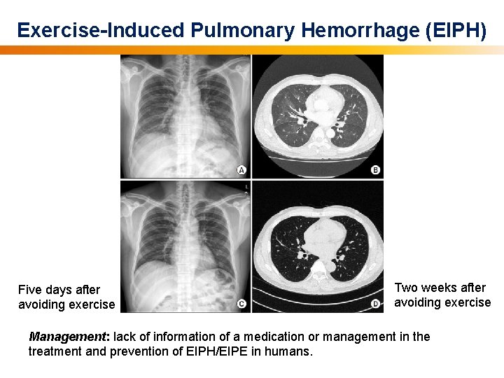 Exercise-Induced Pulmonary Hemorrhage (EIPH) Five days after avoiding exercise Two weeks after avoiding exercise