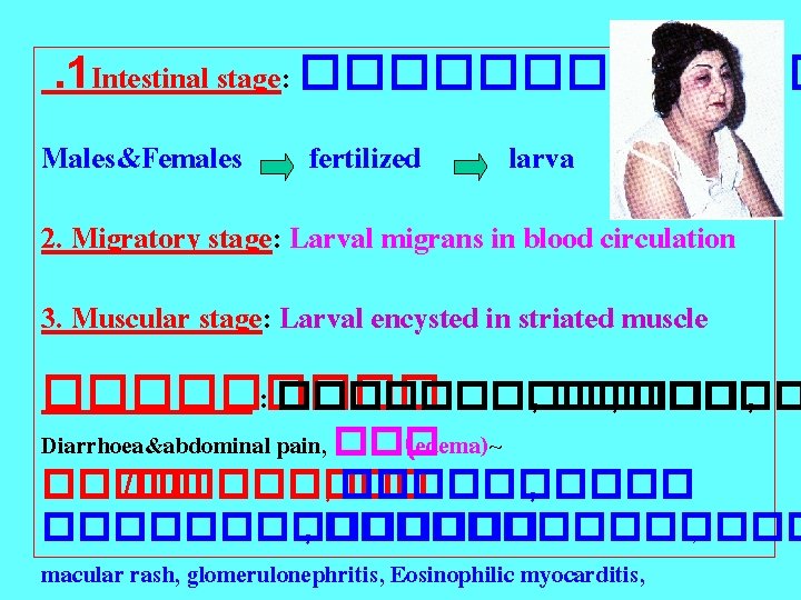 . 1 Intestinal stage: ������ Males&Females fertilized larva 2. Migratory stage: Larval migrans in