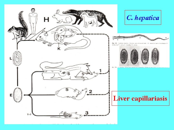 C. hepatica Liver capillariasis 