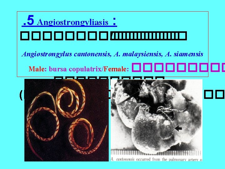 . 5 Angiostrongyliasis : �������� /������ Angiostrongylus cantonensis, A. malaysiensis, A. siamensis Male: bursa