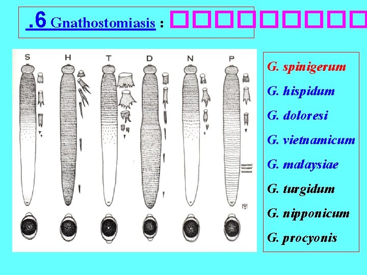 . 6 Gnathostomiasis : ����� G. spinigerum G. hispidum G. doloresi G. vietnamicum G.