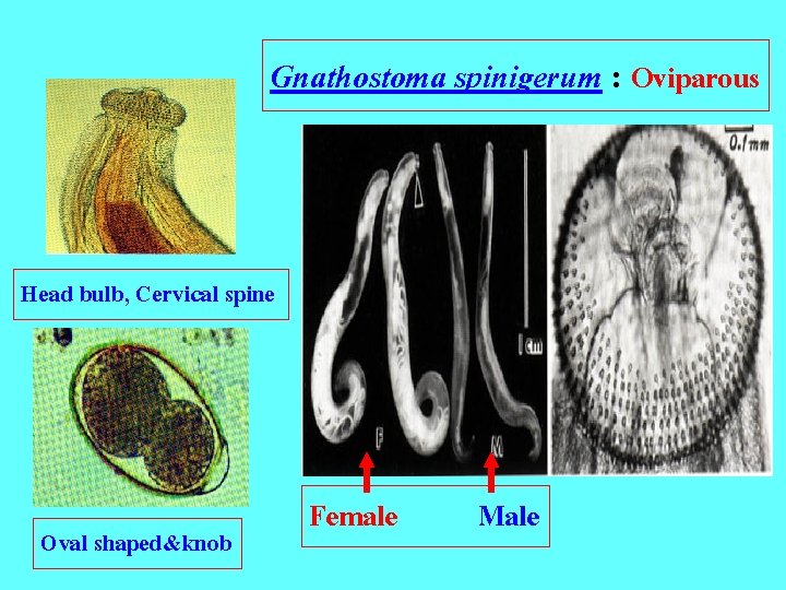 Gnathostoma spinigerum : Oviparous Head bulb, Cervical spine Oval shaped&knob Female Male 
