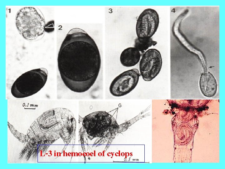 L-3 in hemocoel of cyclops 