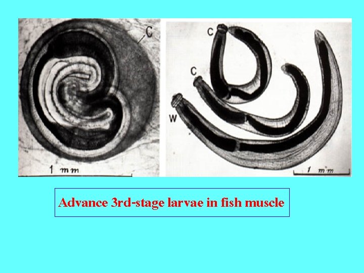 Advance 3 rd-stage larvae in fish muscle 