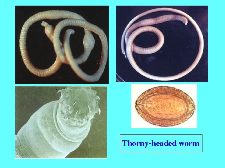 Thorny-headed worm 