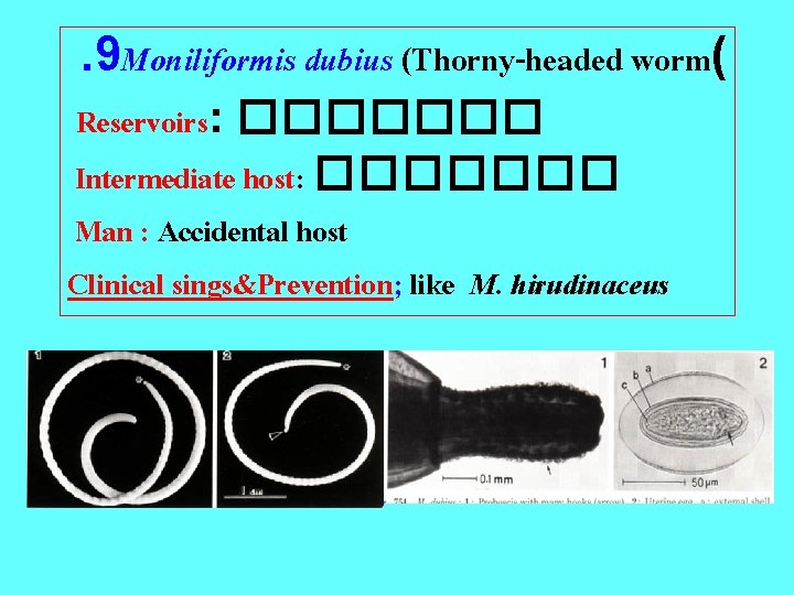 . 9 Moniliformis dubius (Thorny-headed worm( Reservoirs: ������� Intermediate host: ������� Man : Accidental