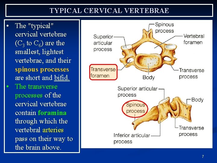 TYPICAL CERVICAL VERTEBRAE • The "typical" cervical vertebrae (C 3 to C 6) are