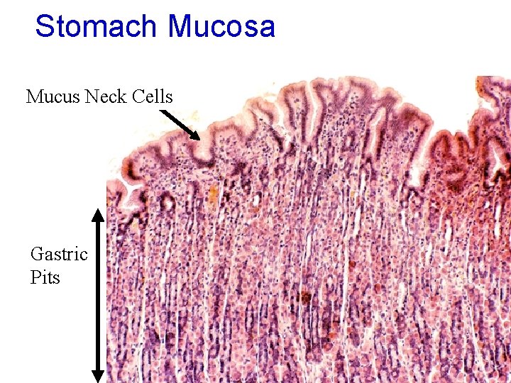 Stomach Mucosa Mucus Neck Cells Gastric Pits 46 