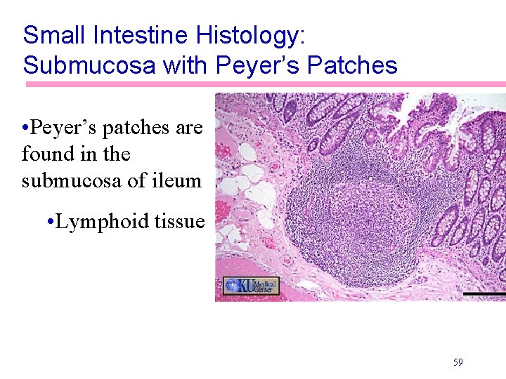 Small Intestine Histology: Submucosa with Peyer’s Patches • Peyer’s patches are found in the
