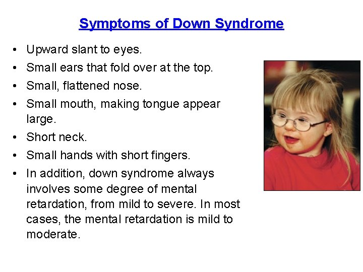 Symptoms of Down Syndrome • • Upward slant to eyes. Small ears that fold