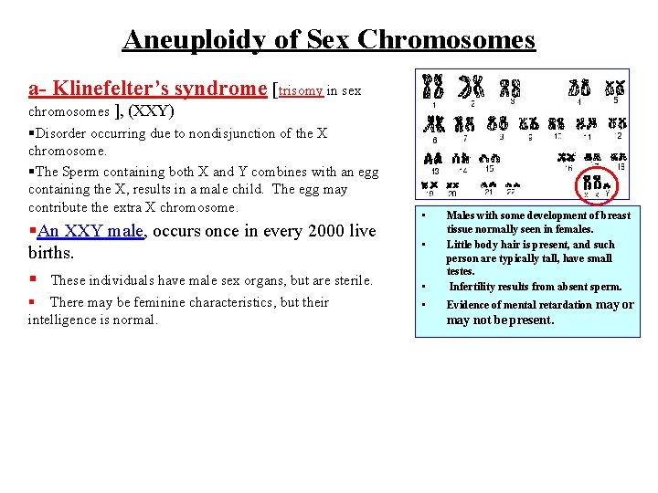 Aneuploidy of Sex Chromosomes a- Klinefelter’s syndrome [trisomy in sex chromosomes ], (XXY) §Disorder