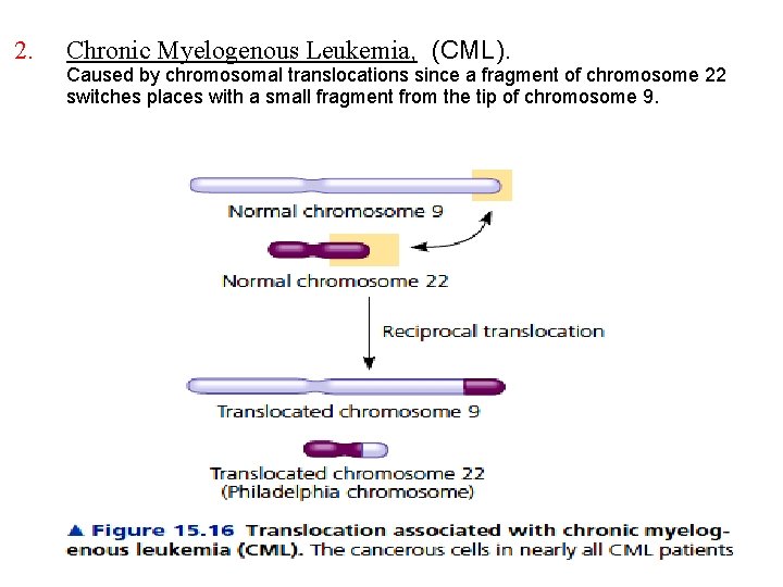 2. Chronic Myelogenous Leukemia, (CML). Caused by chromosomal translocations since a fragment of chromosome