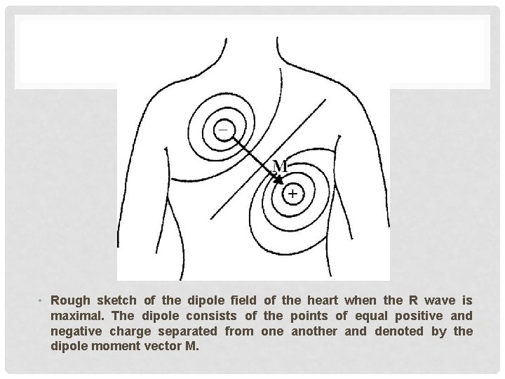  • Rough sketch of the dipole field of the heart when the R