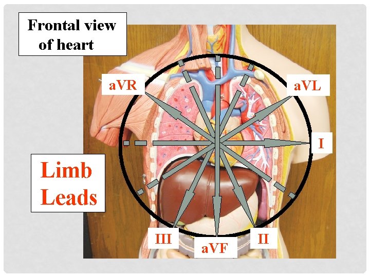 Frontal view of heart a. VR a. VL I Limb Leads III a. VF