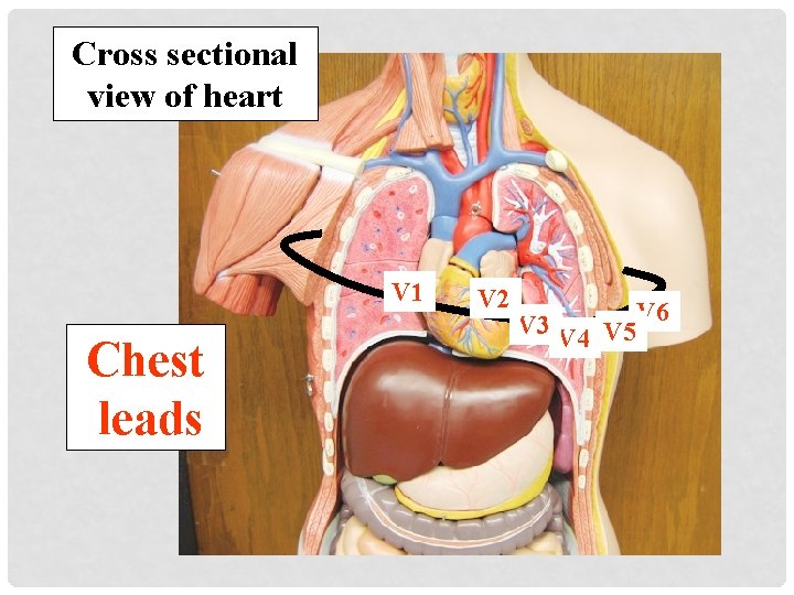 Cross sectional view of heart V 1 Chest leads V 2 V 3 V