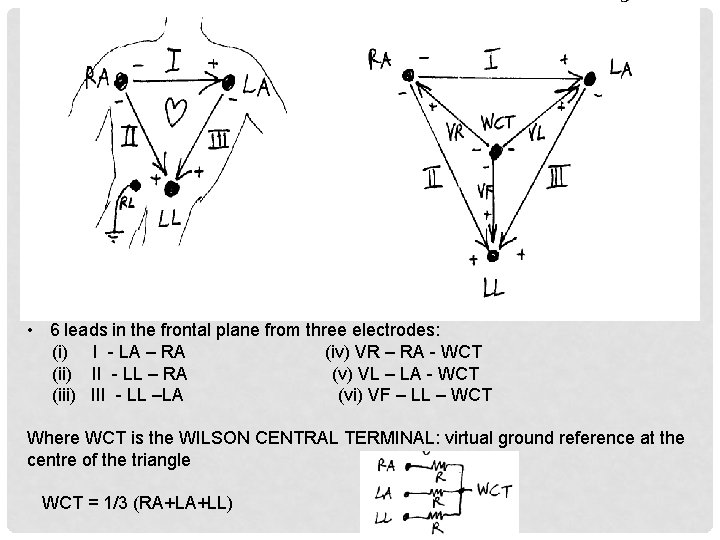  • 6 leads in the frontal plane from three electrodes: (i) I -