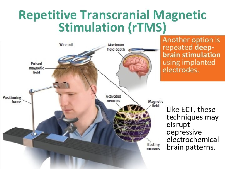 Repetitive Transcranial Magnetic Stimulation (r. TMS) Another option is repeated deepbrain stimulation using implanted Repetitive Transcranial Magnetic Stimulation (r. TMS) Another option is repeated deepbrain stimulation using implanted