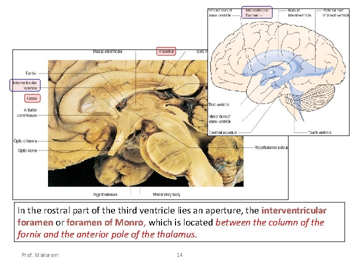 In the rostral part of the third ventricle lies an aperture, the interventricular foramen