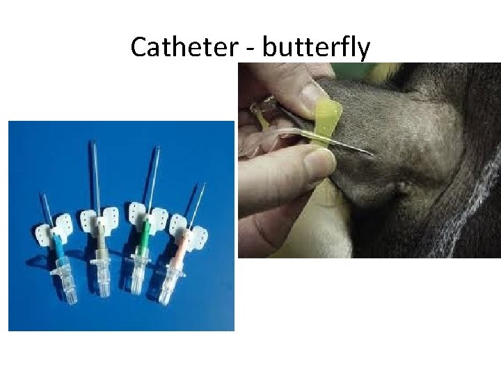 Catheter - butterfly 