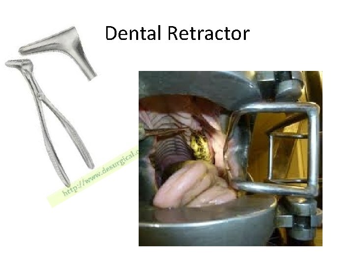 Dental Retractor 