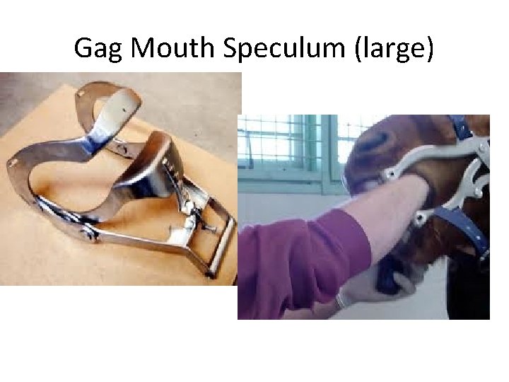 Gag Mouth Speculum (large) 